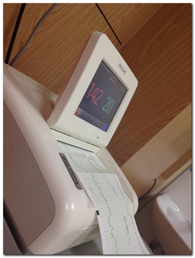 Baby Heartbeat monitor