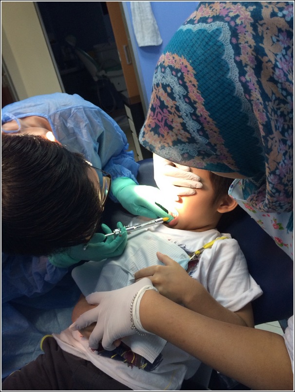 jab for tooth extraction