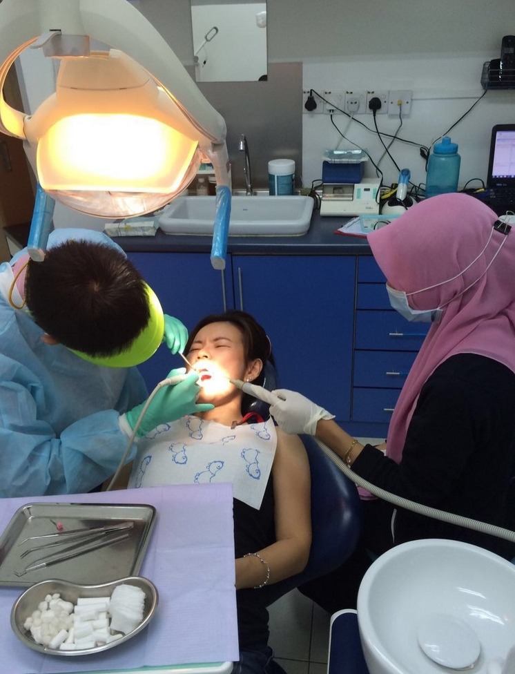 Teeth scaling experience