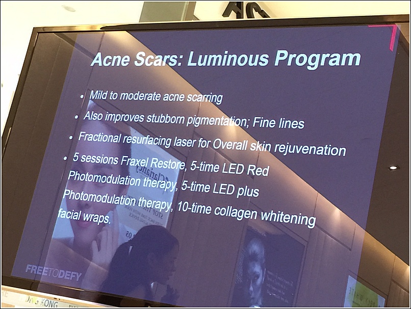 Acne Scar treatment